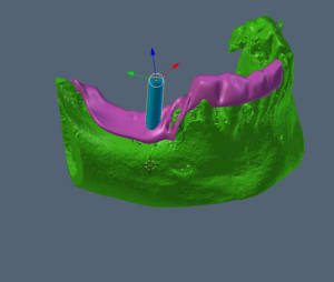 Capture mdfxte - Eugenol