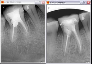 Capture plein  cran 01092011 092453 vlxrjx - Eugenol