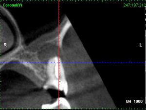Capture plein cran 25022016 183047 absjh5 - Eugenol