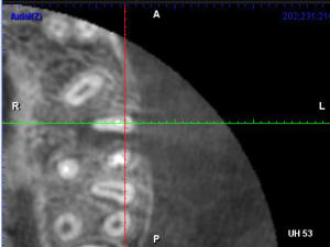Capture plein cran 25022016 183242 qzp2em - Eugenol