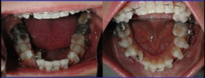 Capturer u2txr6 - Eugenol