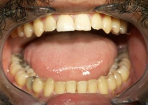 Cas 3 b izilst - Eugenol