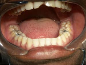 Cas 4 b a1uady - Eugenol