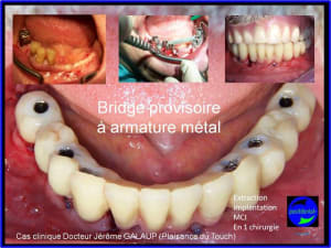 Cas clinique dr j - Eugenol