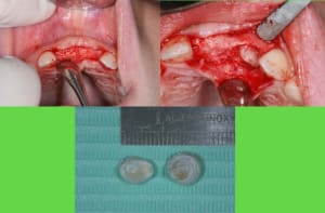 Chirurgie 1 hha7av - Eugenol