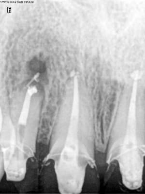 Clich  2013 10 16 16 19 37 ieijss - Eugenol