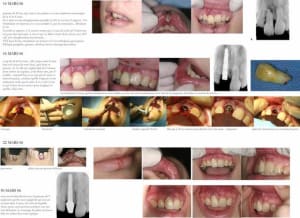 Cuevas recap 200 ko gqv2lg - Eugenol