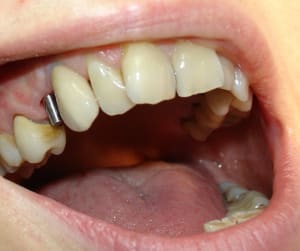 Dsc00013 aidxft - Eugenol