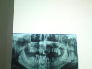 Dsc00644 2 sv3d3g - Eugenol
