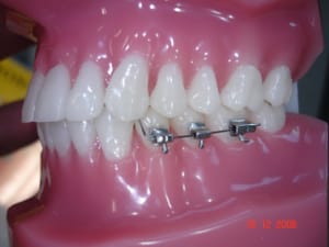 Dsc01001 eqgxv4 - Eugenol