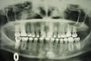 Dsc01882 yfjl7y - Eugenol