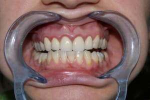 Dsc02699 z4gtnt - Eugenol