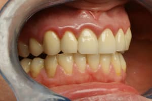 Dsc02702 xn4vle - Eugenol