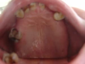 Dsc02888 y0jqtt - Eugenol