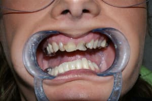 Dsc03297  1  kdymqy - Eugenol
