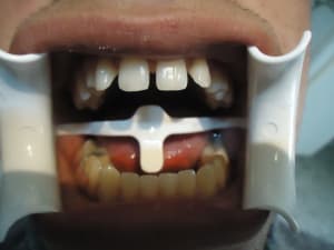 Dsc03972 yfug9m - Eugenol