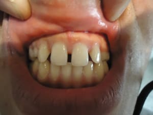 Dsc03973 x9f6mi - Eugenol