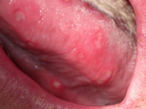 Dscn0007 p2axwf - Eugenol
