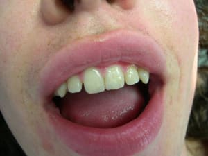 Dscn0074 cwcpl3 - Eugenol