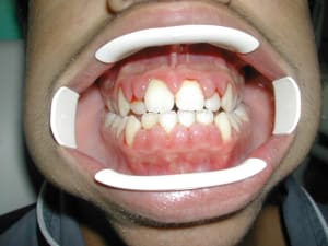 Dscn1553 gaxwvi - Eugenol