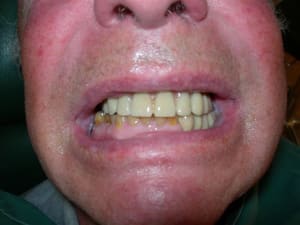 Dscn1863 f89k2v - Eugenol