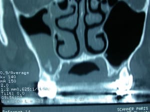 Dscn2063 scavew - Eugenol