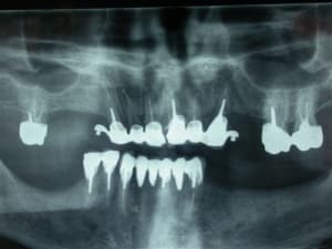 Dscn2607 qrisbe - Eugenol