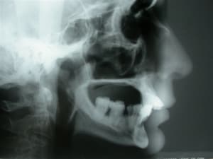 Dscn2702 tifjl3 - Eugenol