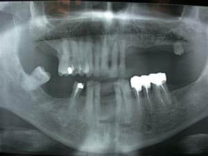 Dscn2872 jhhe7o - Eugenol