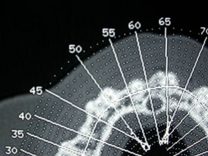 Dscn3241 fbmrgx - Eugenol