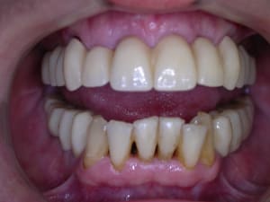 Dscn6837 rky0y7 - Eugenol