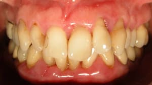 Dscn7030 tz4jtf - Eugenol