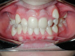 Dscn7792 qkoka2 - Eugenol