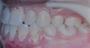Dsc 0003 bghk3u - Eugenol