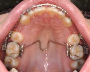 Dsc 0006 piv60m - Eugenol