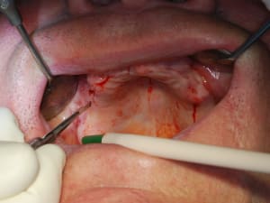 Dsc 0010 ew3yuj - Eugenol