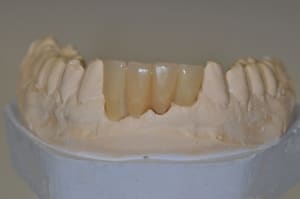 Dsc 0019 xqsiis - Eugenol