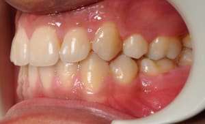 Dsc 0019 y57e2m - Eugenol