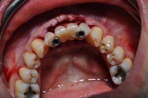 Dsc 0026 qdo5xk - Eugenol