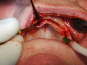 Dsc 0065 wio8nl - Eugenol