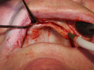 Dsc 0066 dz2n3k - Eugenol