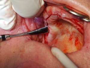 Dsc 0077 ugxufz - Eugenol