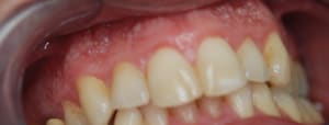 Dsc 0082 lfa3b6 - Eugenol