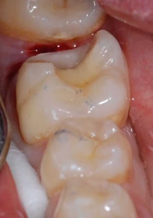 Dsc 0087 bkyhe2 - Eugenol