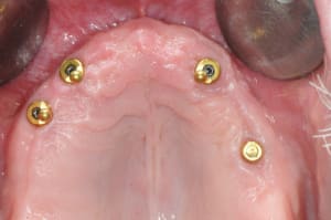 Dsc 0091 kn5smt - Eugenol