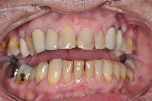 Dsc 0122 jn7rdh - Eugenol