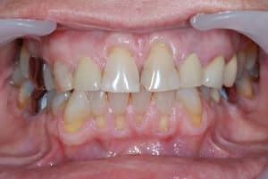 Dsc 0146 f7etkj - Eugenol