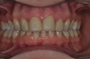 Dsc 0159 npnww2 - Eugenol