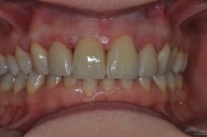 Dsc 0162 x9wfjn - Eugenol