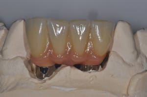Dsc 0217 ddroww - Eugenol